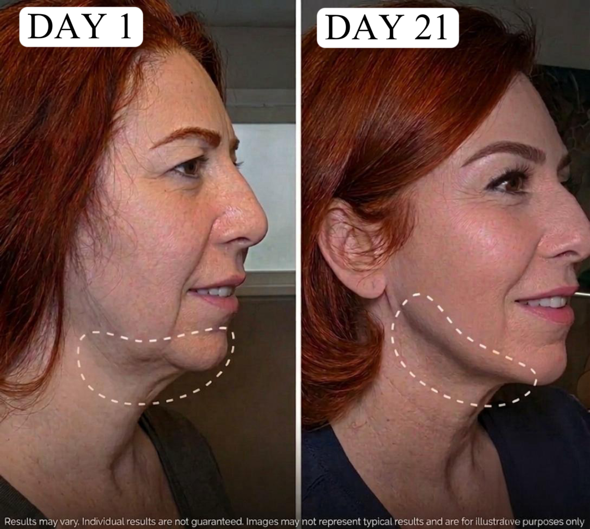 Face Lifting Massager